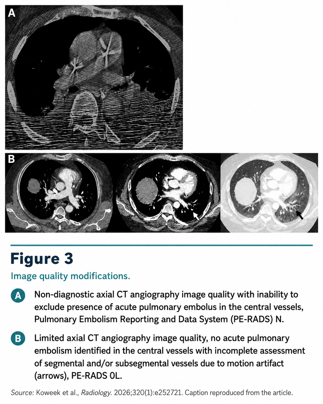 PE-RADS figure 3 image quality modifiers