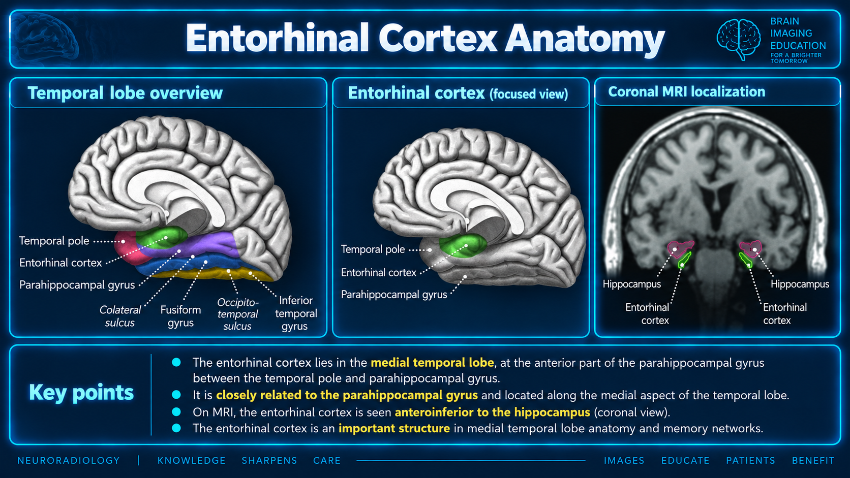 Medial brain diagrams and coronal MRI labeling entorhinal cortex and hippocampus