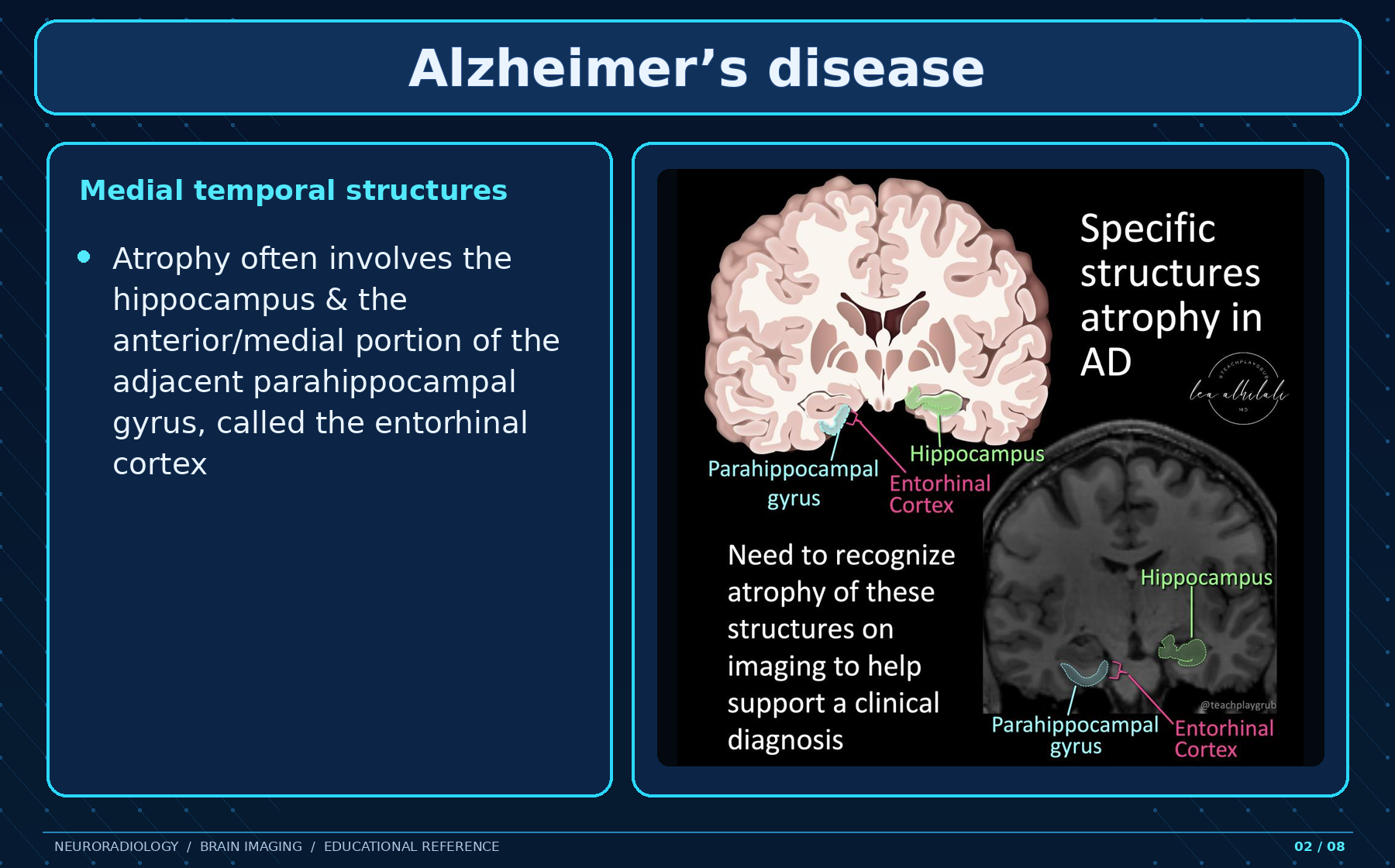Medial temporal structures