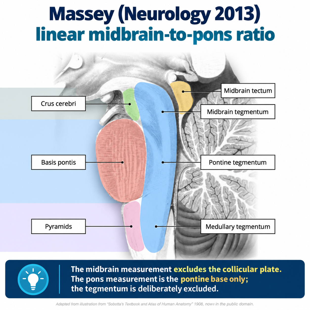 Sagittal brainstem diagram showing the midbrain and pontine regions used for the Massey linear ratio