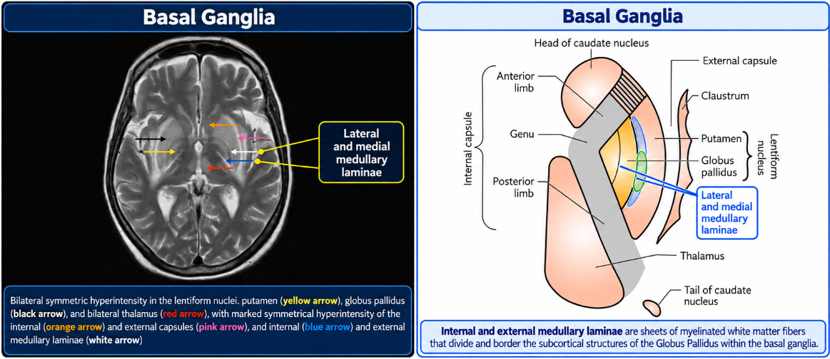 Basal ganglia MRI and anatomy diagram