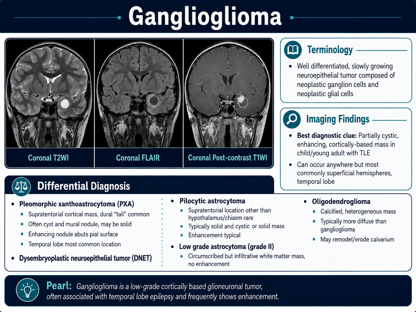 Ganglioglioma