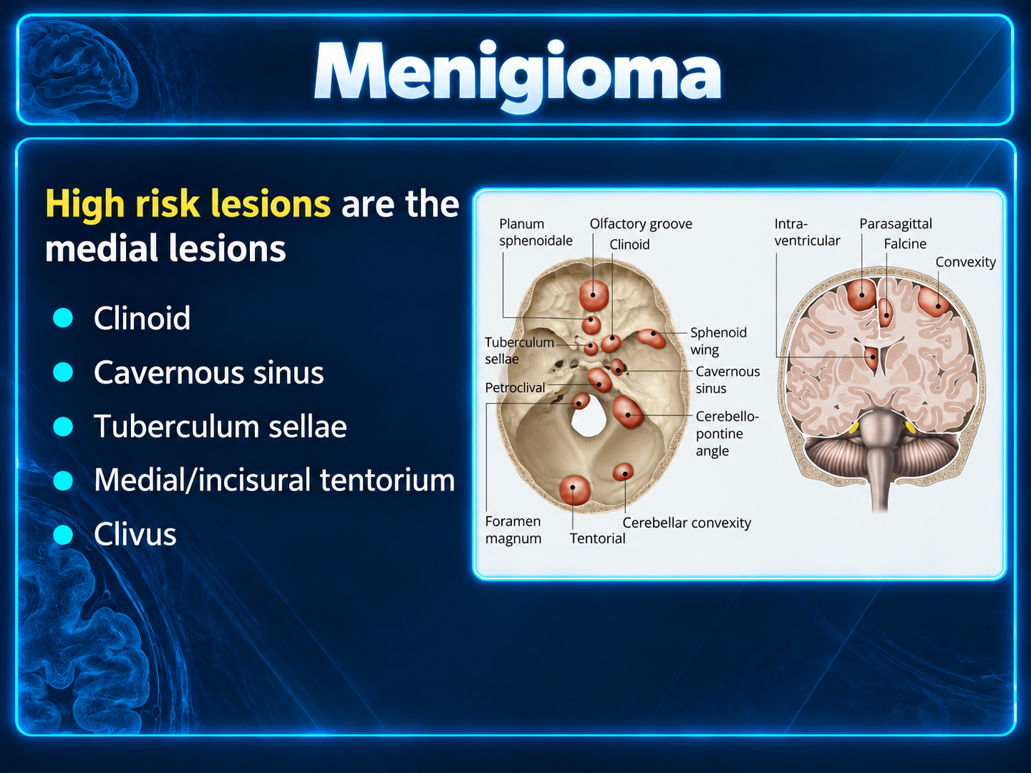 Teaching slide listing medial high-risk sites beside skull-base and coronal anatomical diagrams.