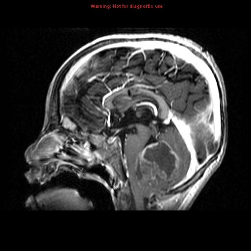 Patient A