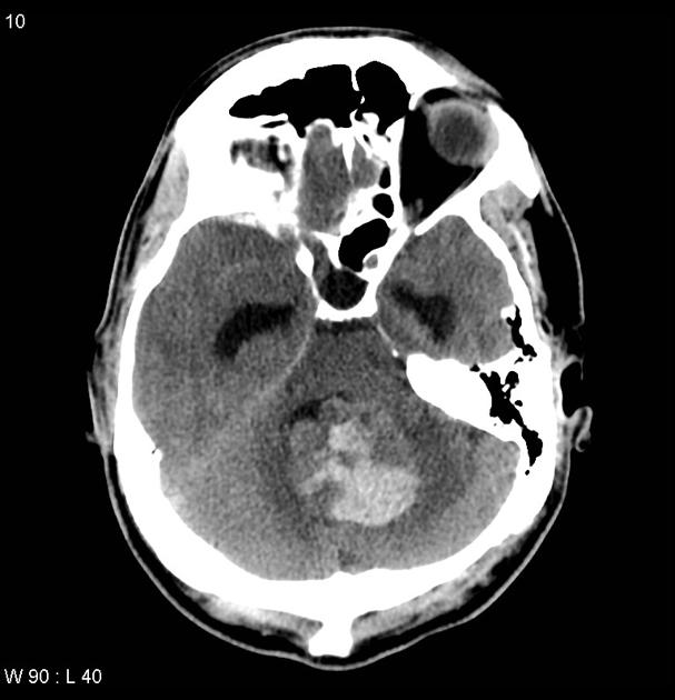 Patient B