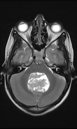 Patient C