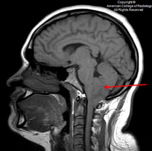 T1 - 25-year-old female