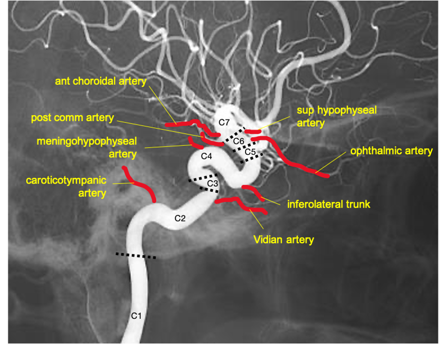 Angiographic ICA branches by segment