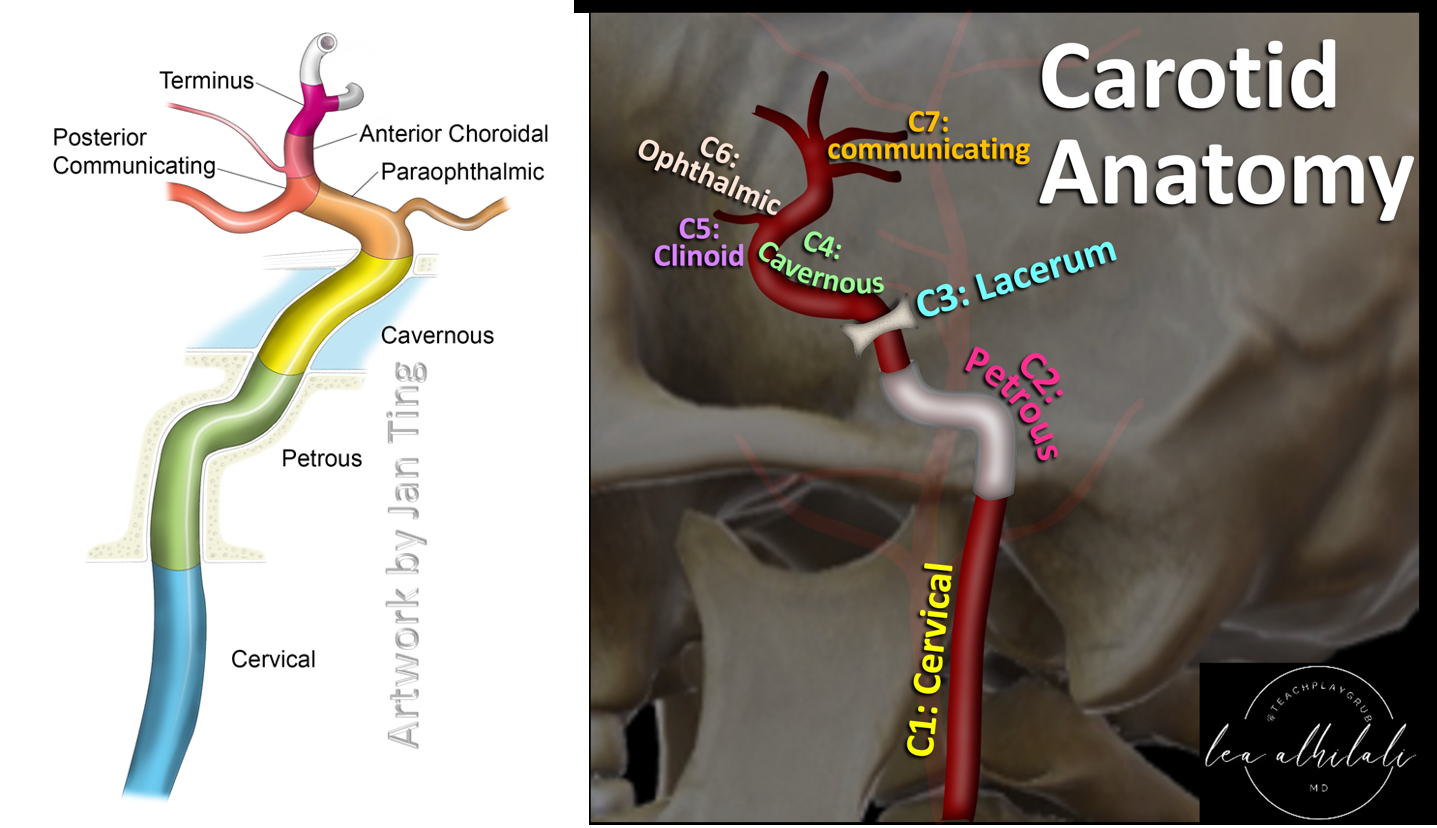 ICA course anatomy