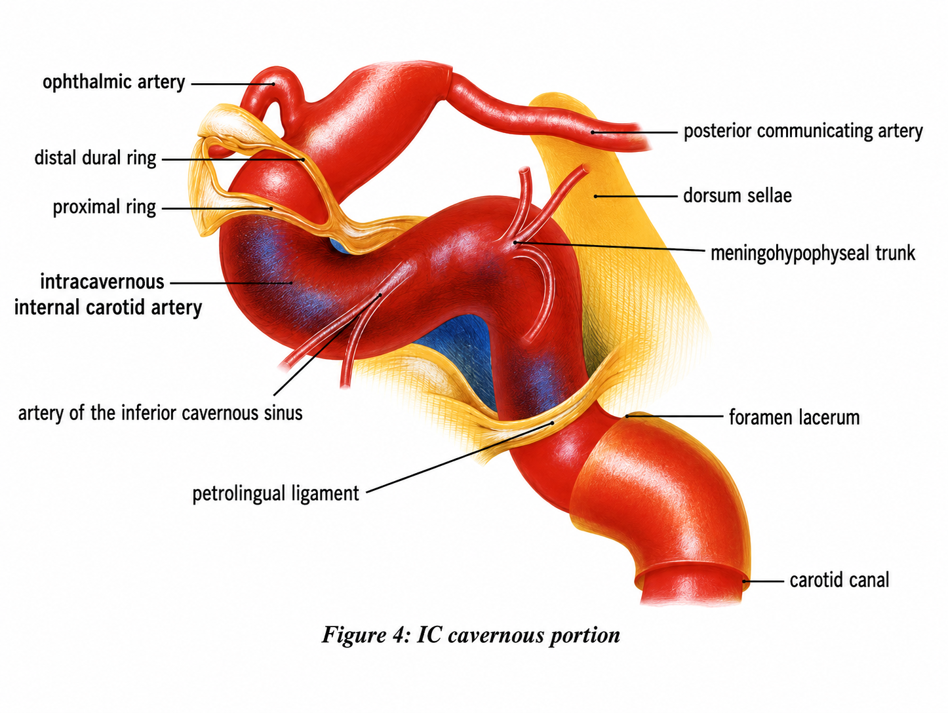 Cavernous ICA and dural rings