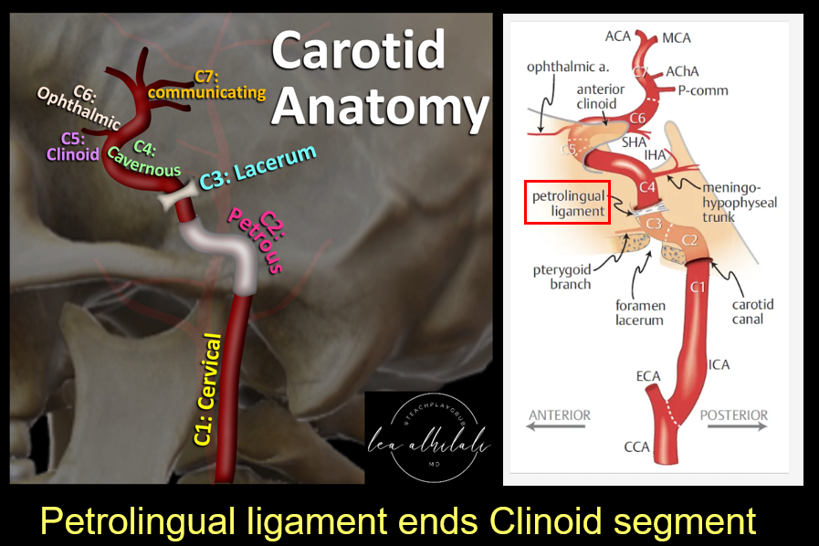 Petrolingual ligament and ICA segments