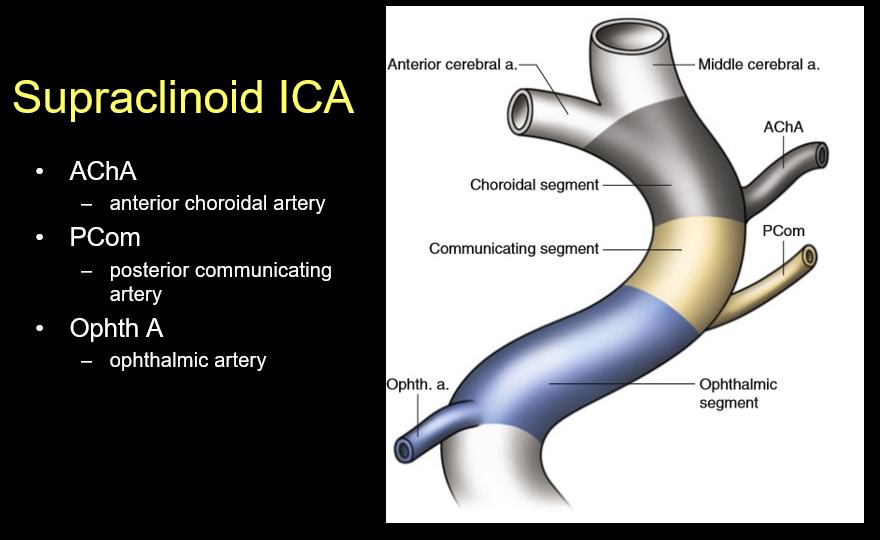 Supraclinoid ICA branches