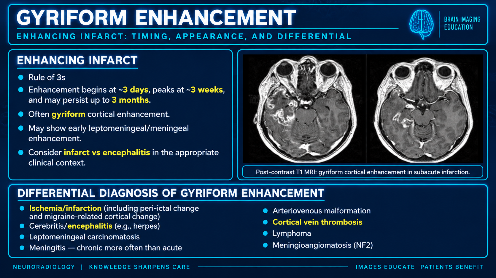 Postcontrast T1 MRI demonstrating gyriform cortical enhancement in subacute infarction with a differential diagnosis summary
