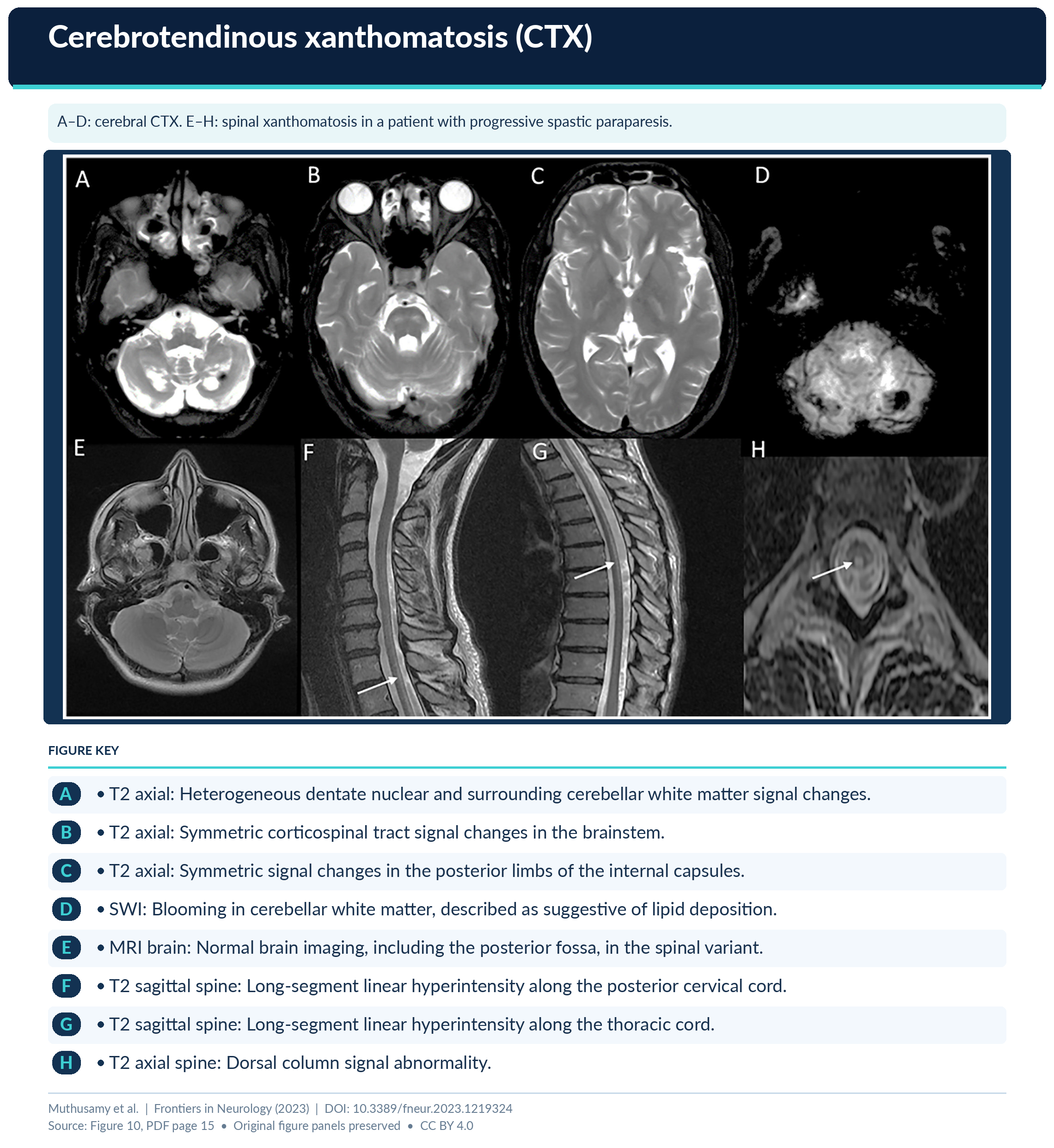 Figure 10 Formatted