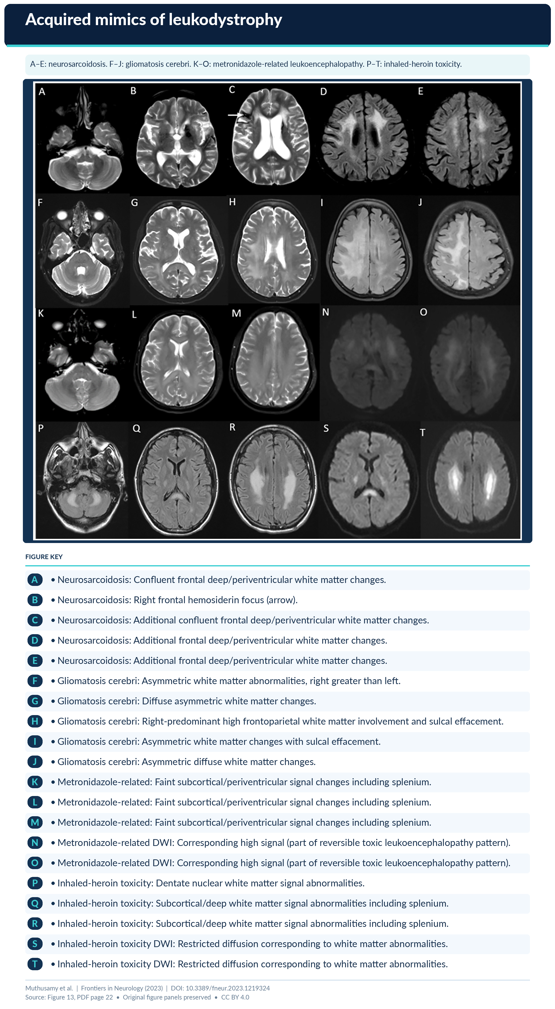 Figure 13 Formatted