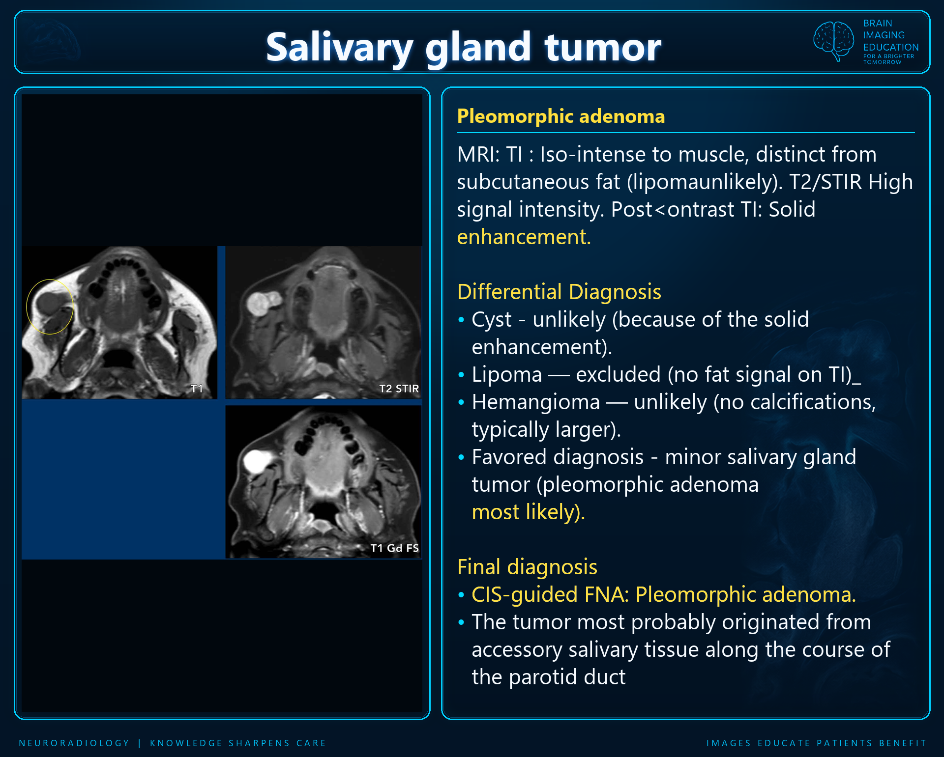 Teaching slide with axial T1, T2 STIR and contrast-enhanced fat-suppressed T1 MRI showing a circumscribed right buccal mass