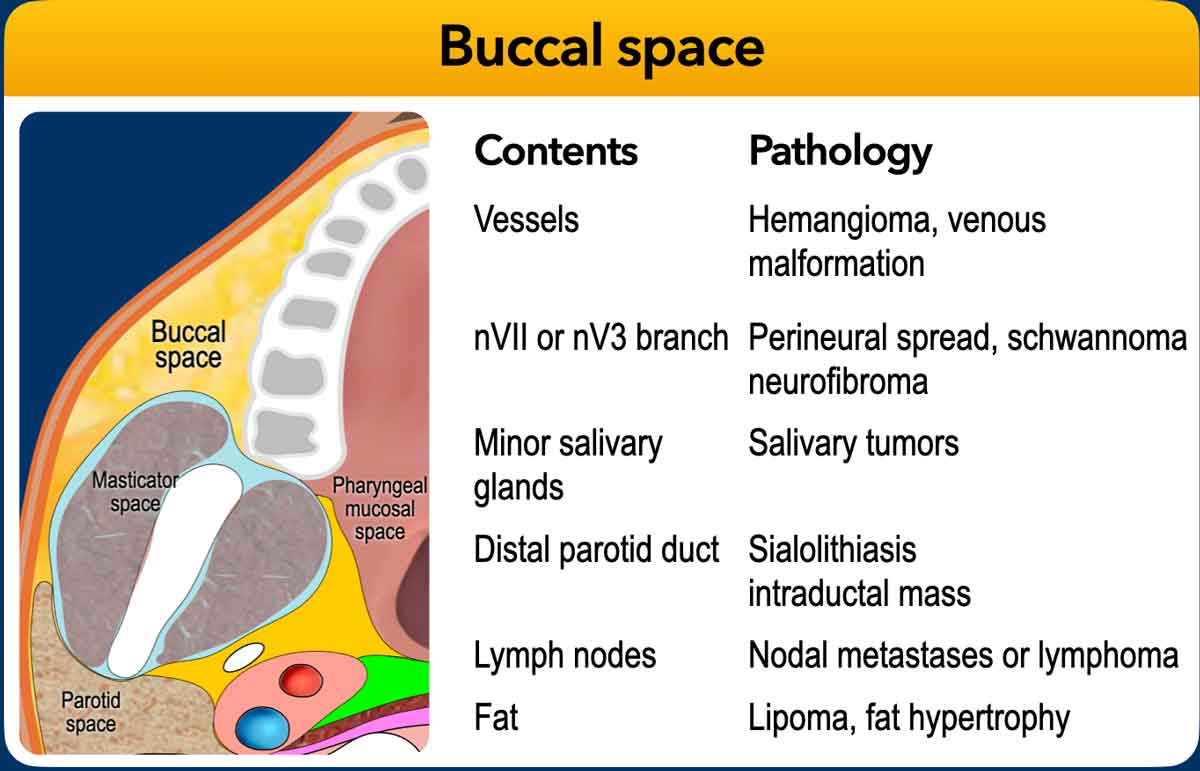 Teaching slide showing a buccal space anatomy diagram beside a contents and pathology table.