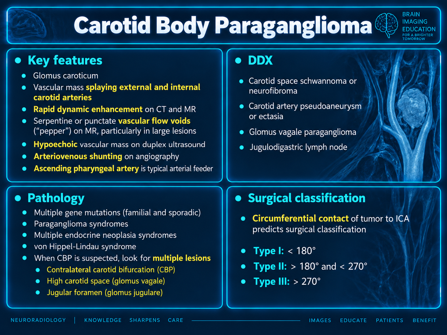 Carotid Body Tumor