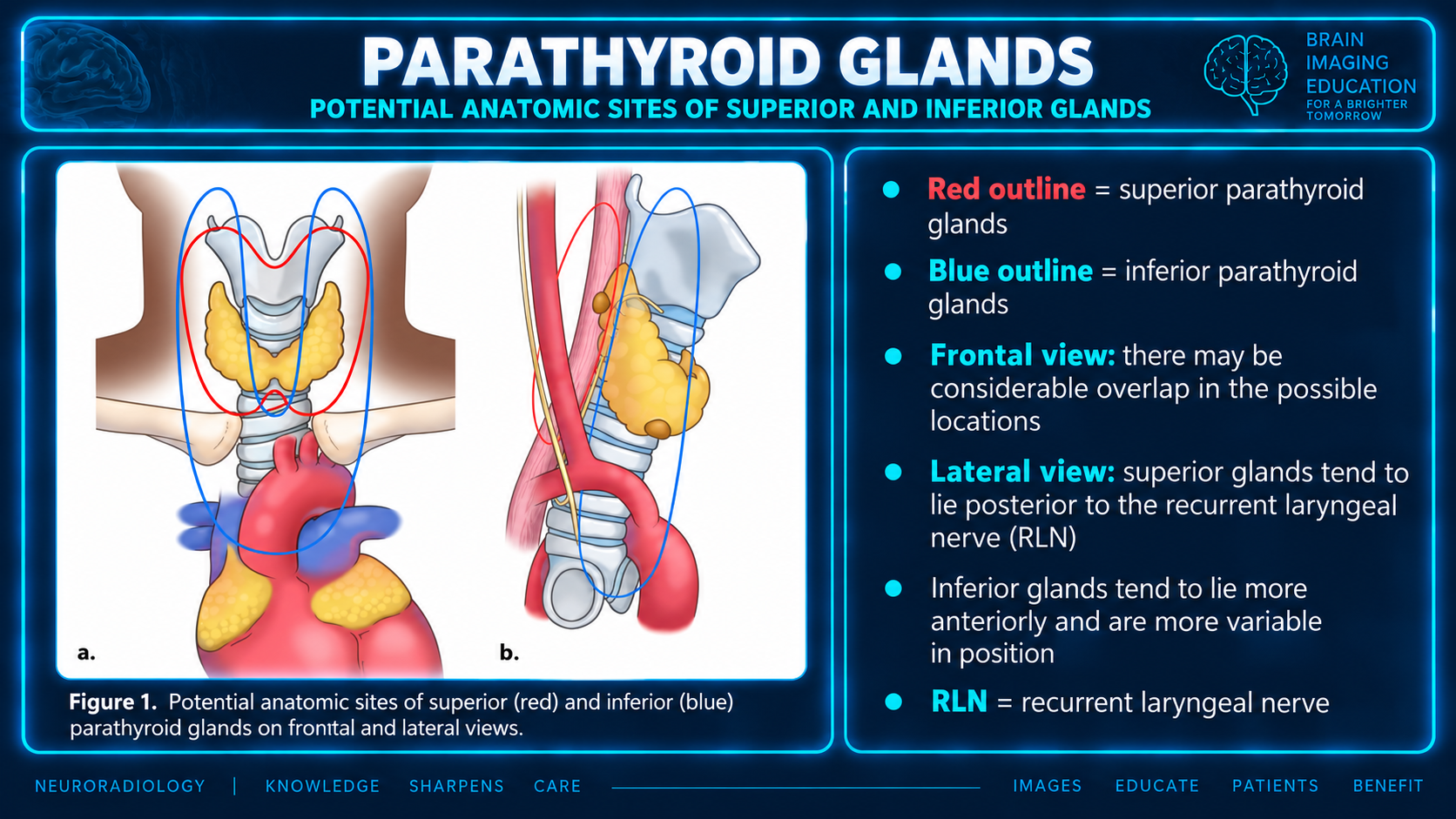 Frontal and lateral illustrations of potential superior and inferior parathyroid gland locations and their relationship to the recurrent laryngeal nerve