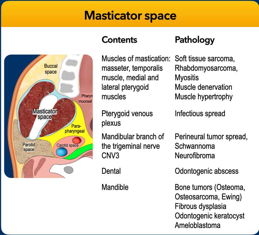 Teaching slide with a masticator space diagram and a contents–pathology table.