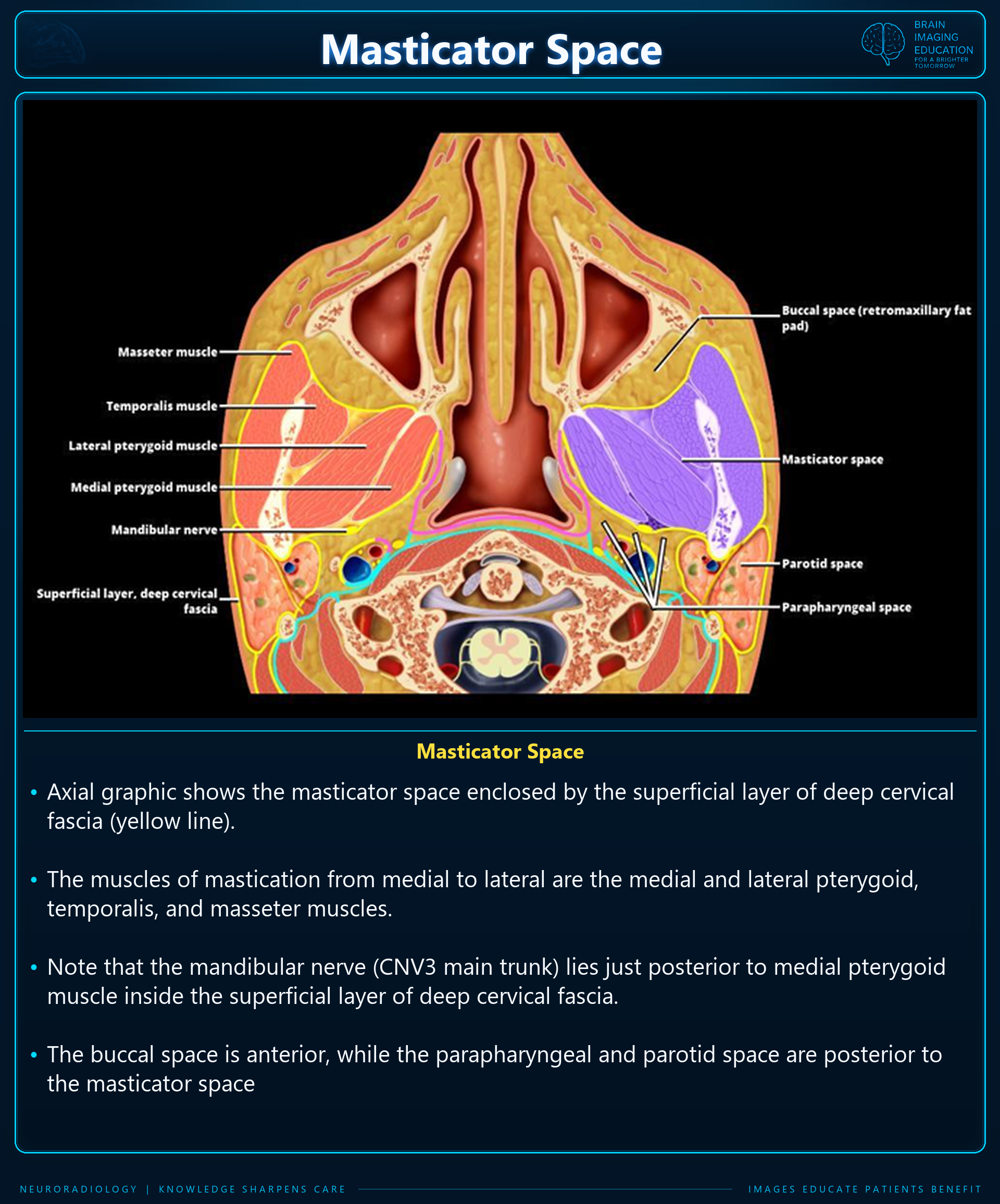 Axial anatomic illustration of the masticator space, muscles of mastication, mandibular nerve, fascia and neighboring spaces, with explanatory text.