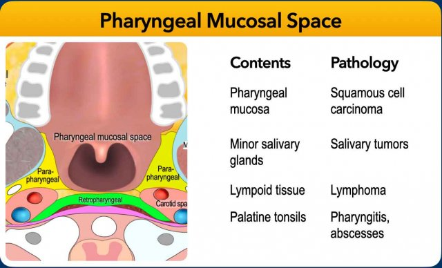 Comparison teaching slide with an axial diagram of the pharyngeal mucosal space and lists of mucosa, minor salivary glands, lymphoid tissue, palatine tonsils and associated pathology.