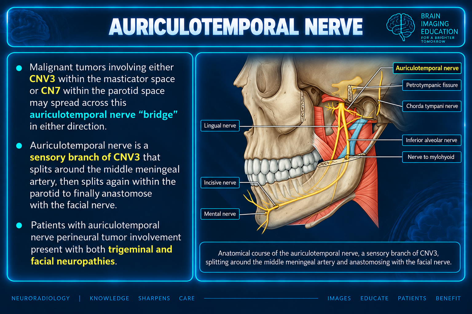 Labeled lateral skull diagram showing the auriculotemporal nerve and mandibular nerve branches.