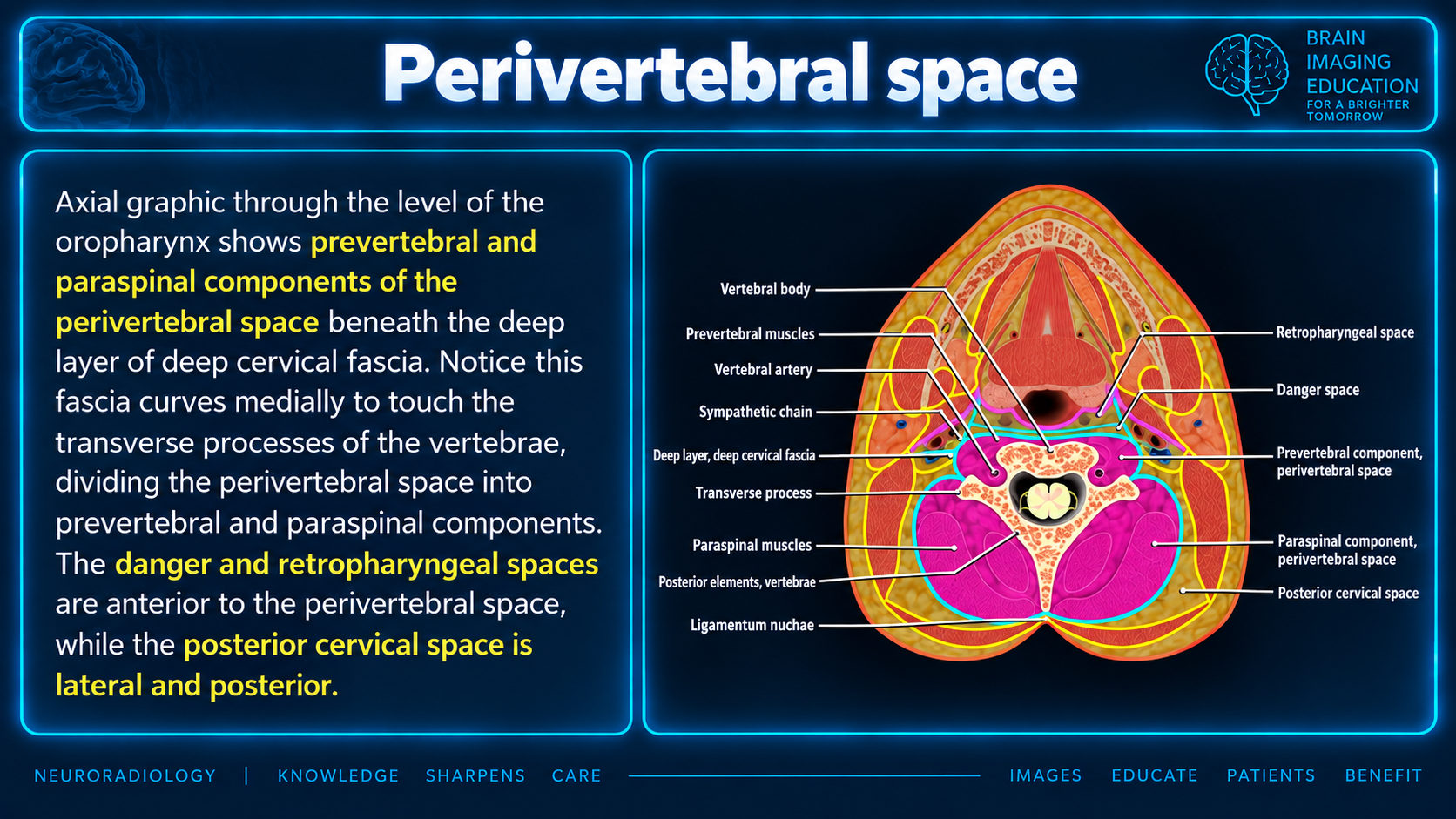 Axial teaching diagram at the oropharynx labeling the perivertebral components, deep cervical fascia, vertebra, muscles and adjacent neck spaces.