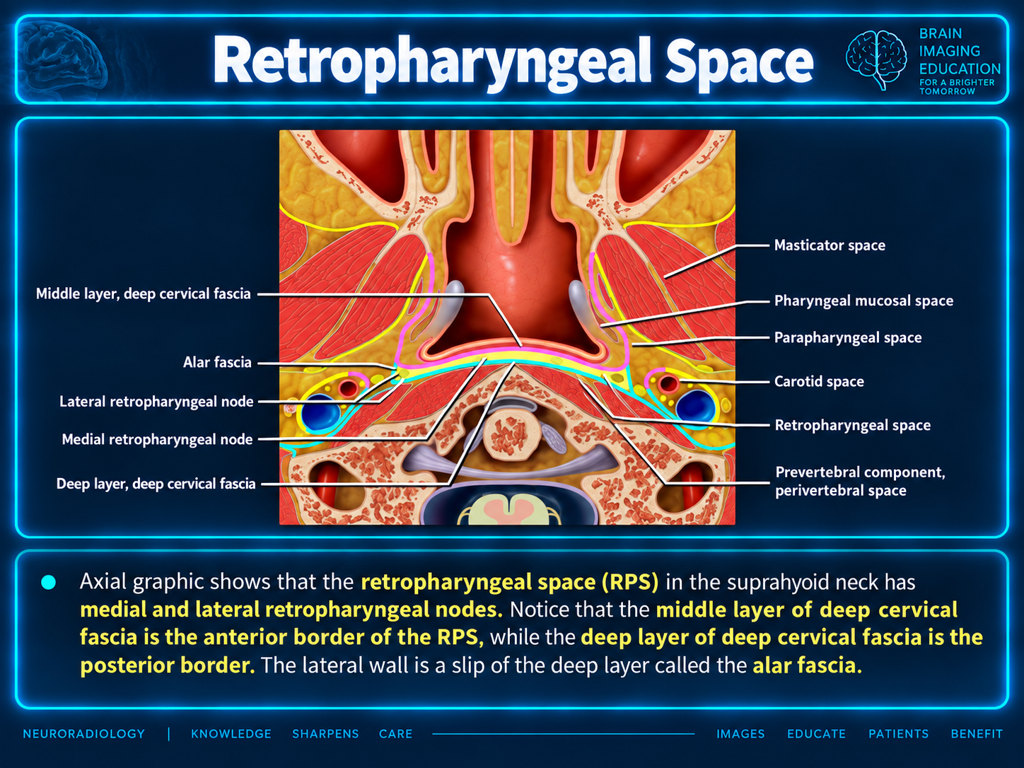 Axial teaching graphic labeling retropharyngeal nodes, fascial layers and adjacent neck spaces.