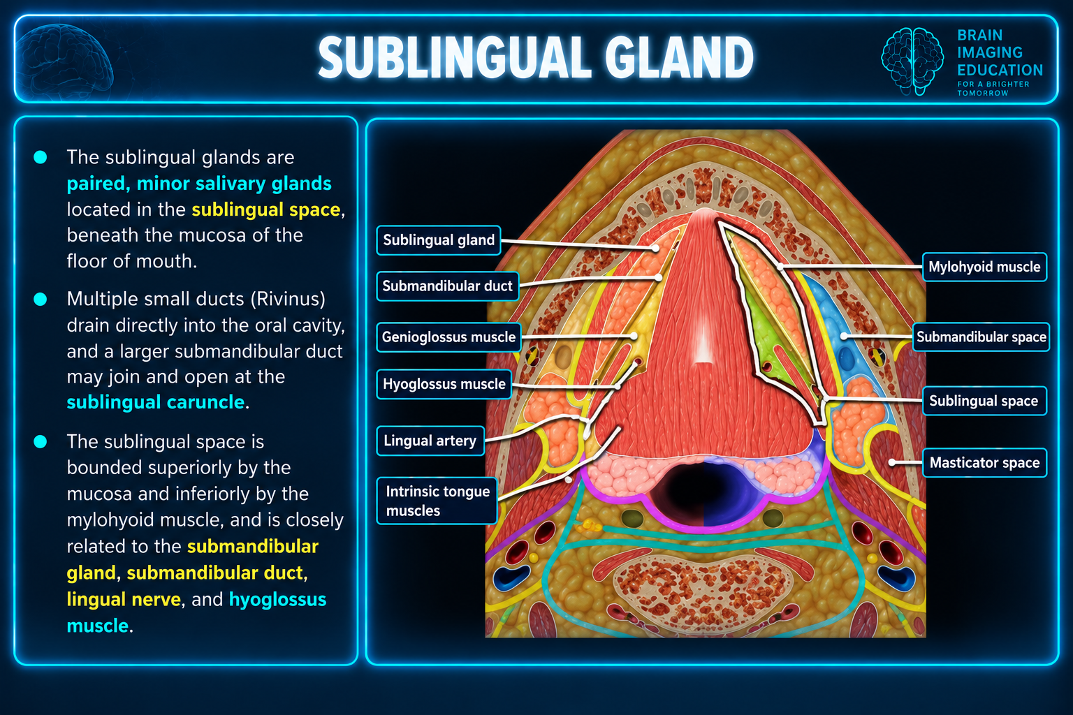 Axial anatomic teaching diagram with labeled sublingual and submandibular spaces