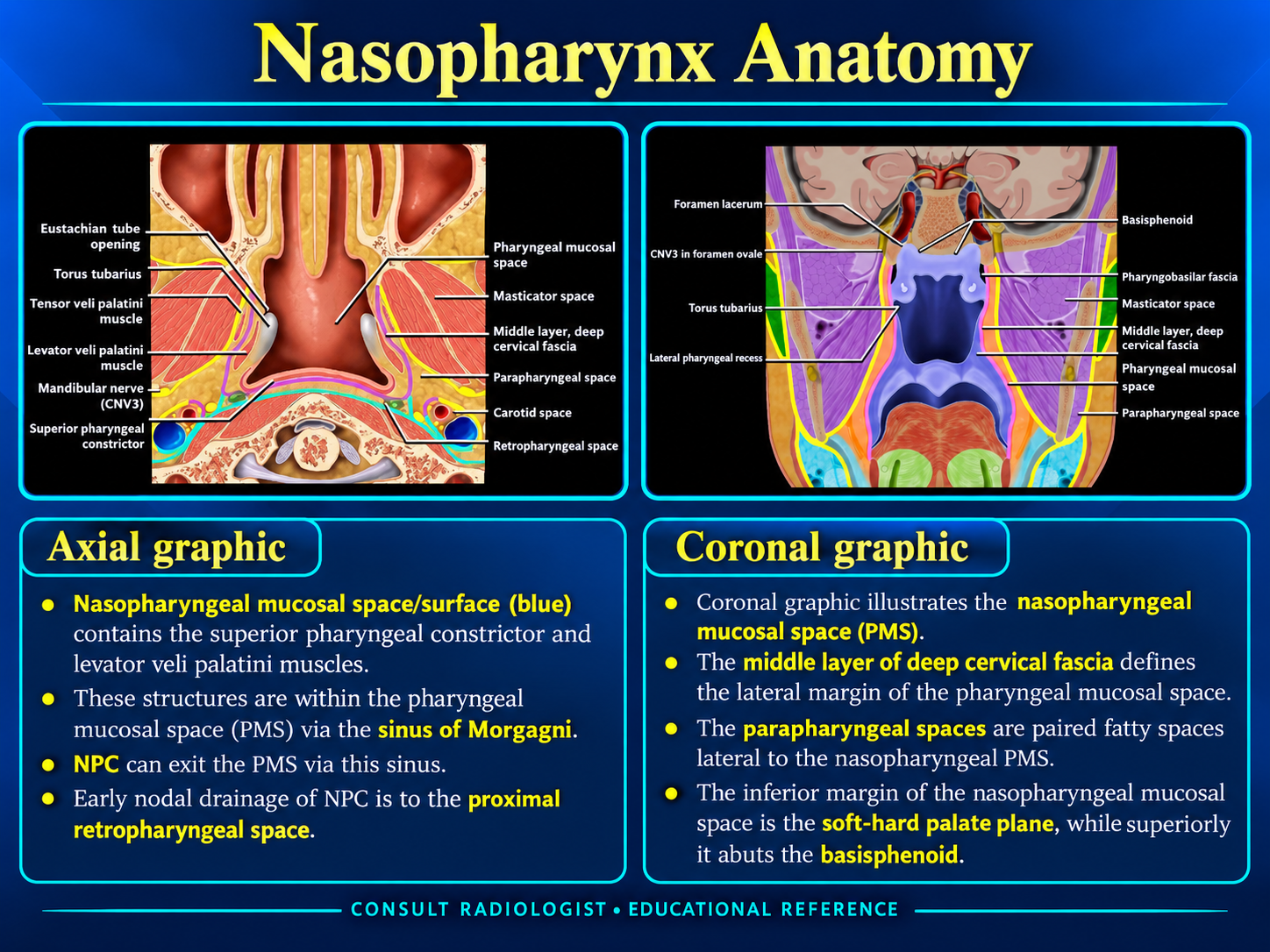 Axial and coronal nasopharyngeal anatomy