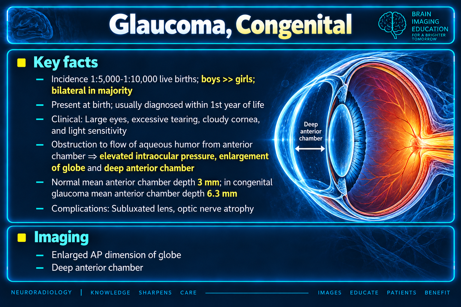 Congenital Glaucoma