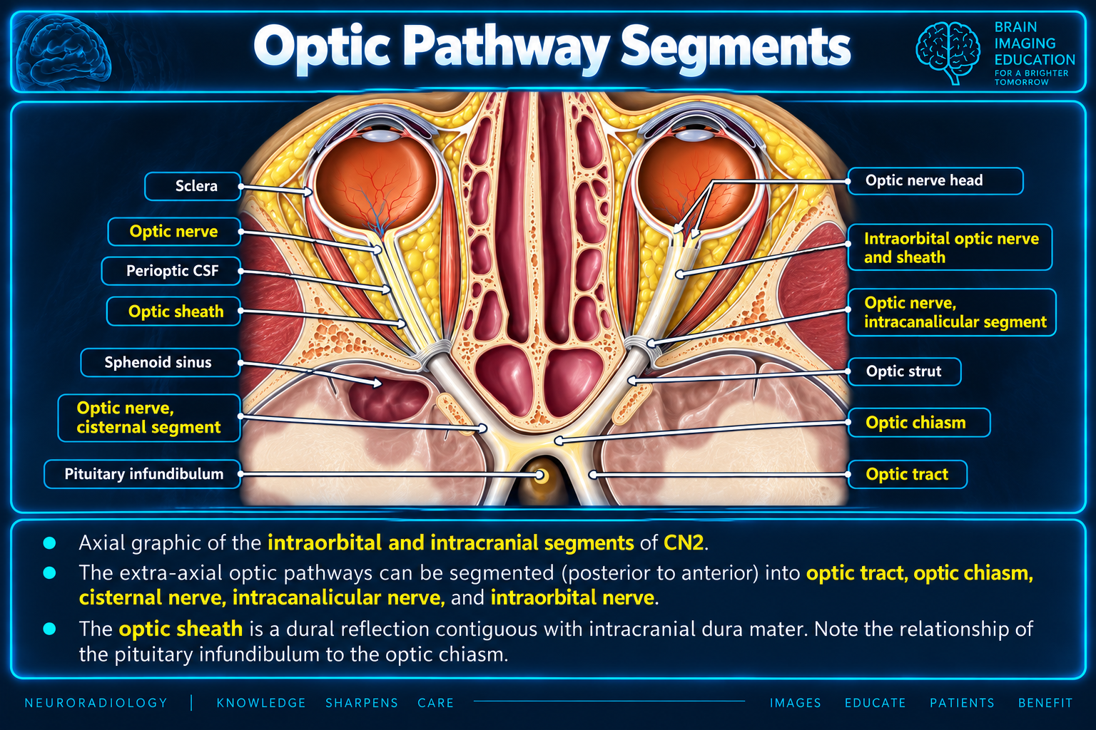 Optic pathway segments