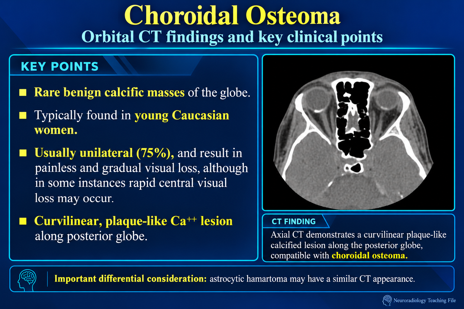 Orbital CT findings and key clinical points of a choroidal osteoma