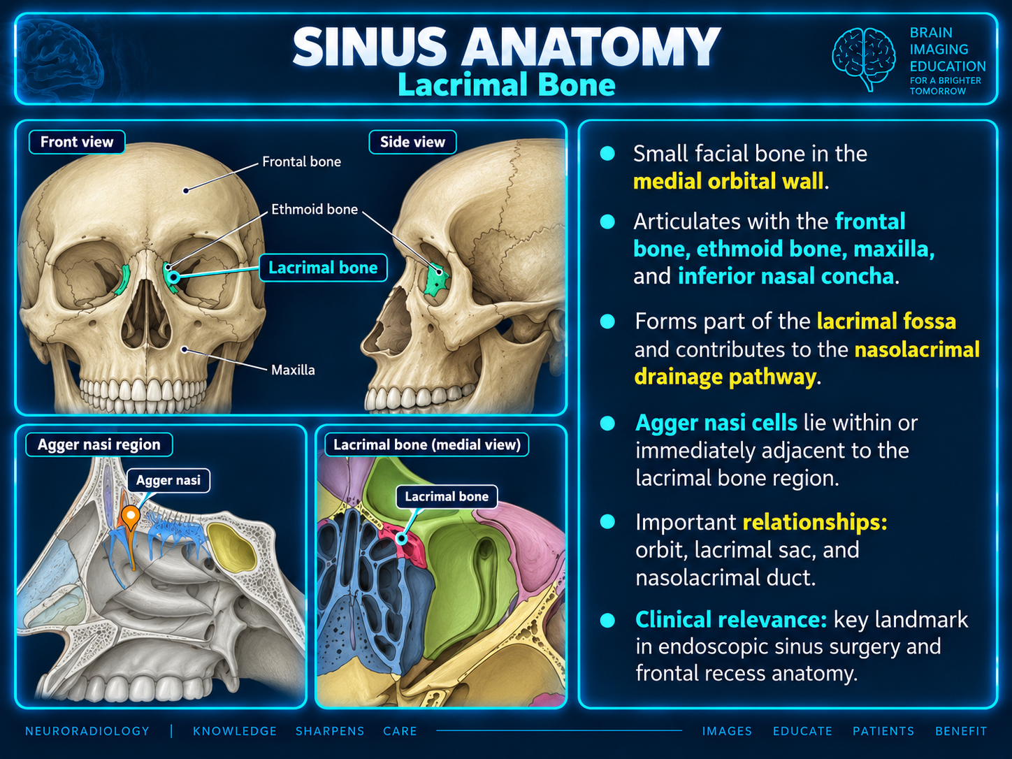 Lacrimal bone and agger nasi region