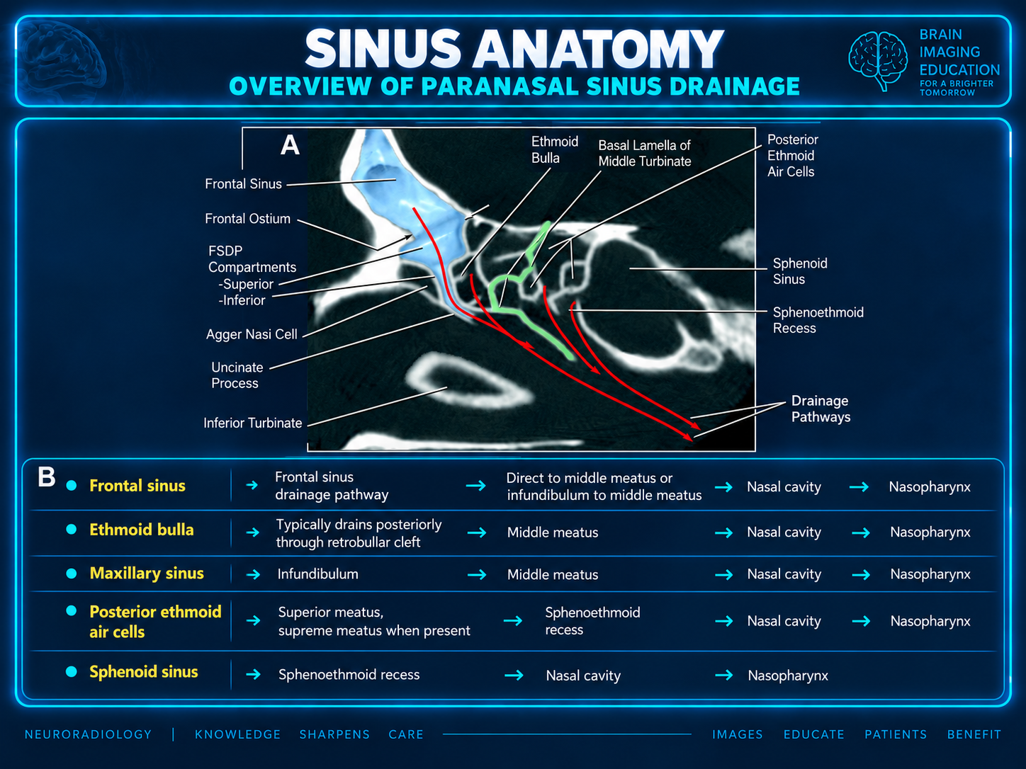 Paranasal sinus drainage overview