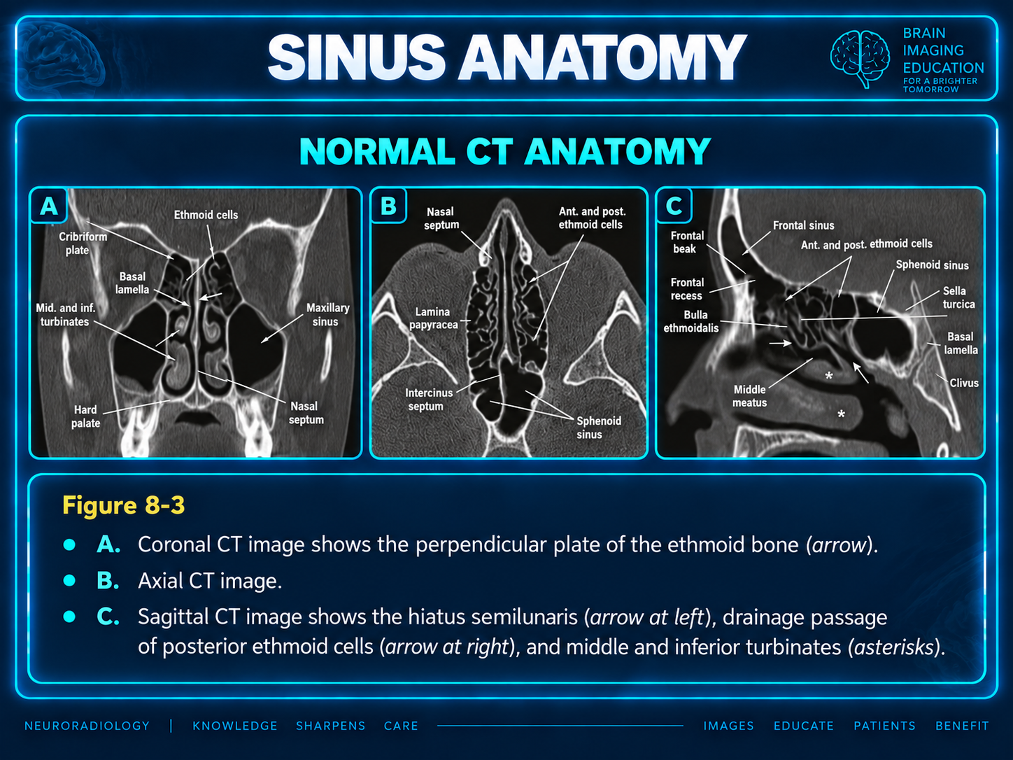 Normal anatomy: coronal, axial and sagittal CT