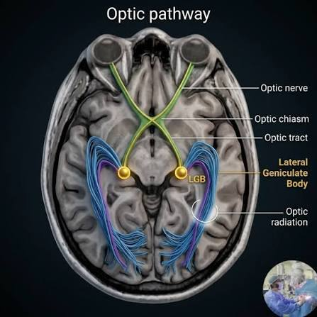 Diagram of the optic nerves, chiasm, tracts, lateral geniculate bodies, and optic radiations
