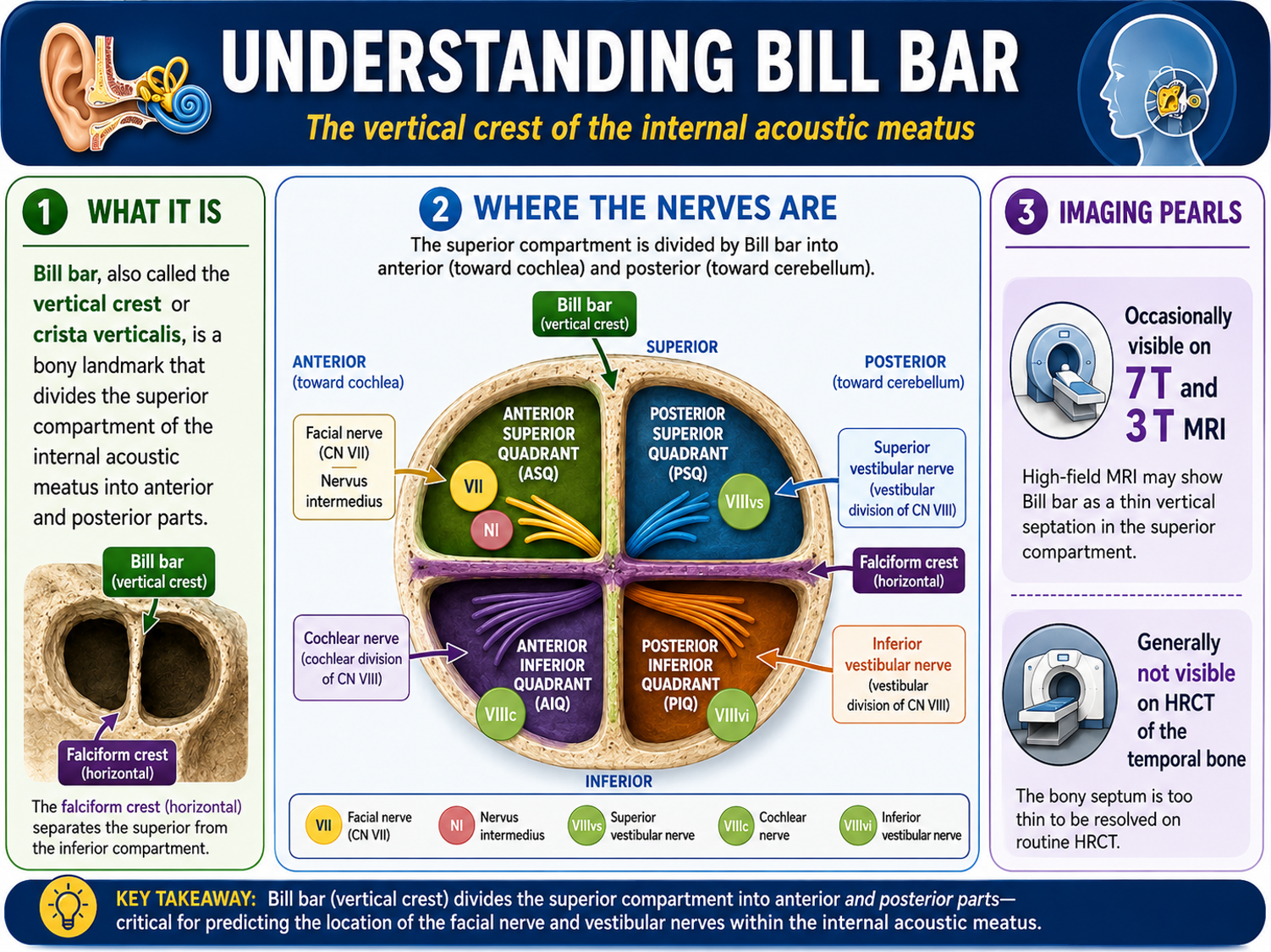 Infographic explaining Bill bar and the four internal auditory canal quadrants