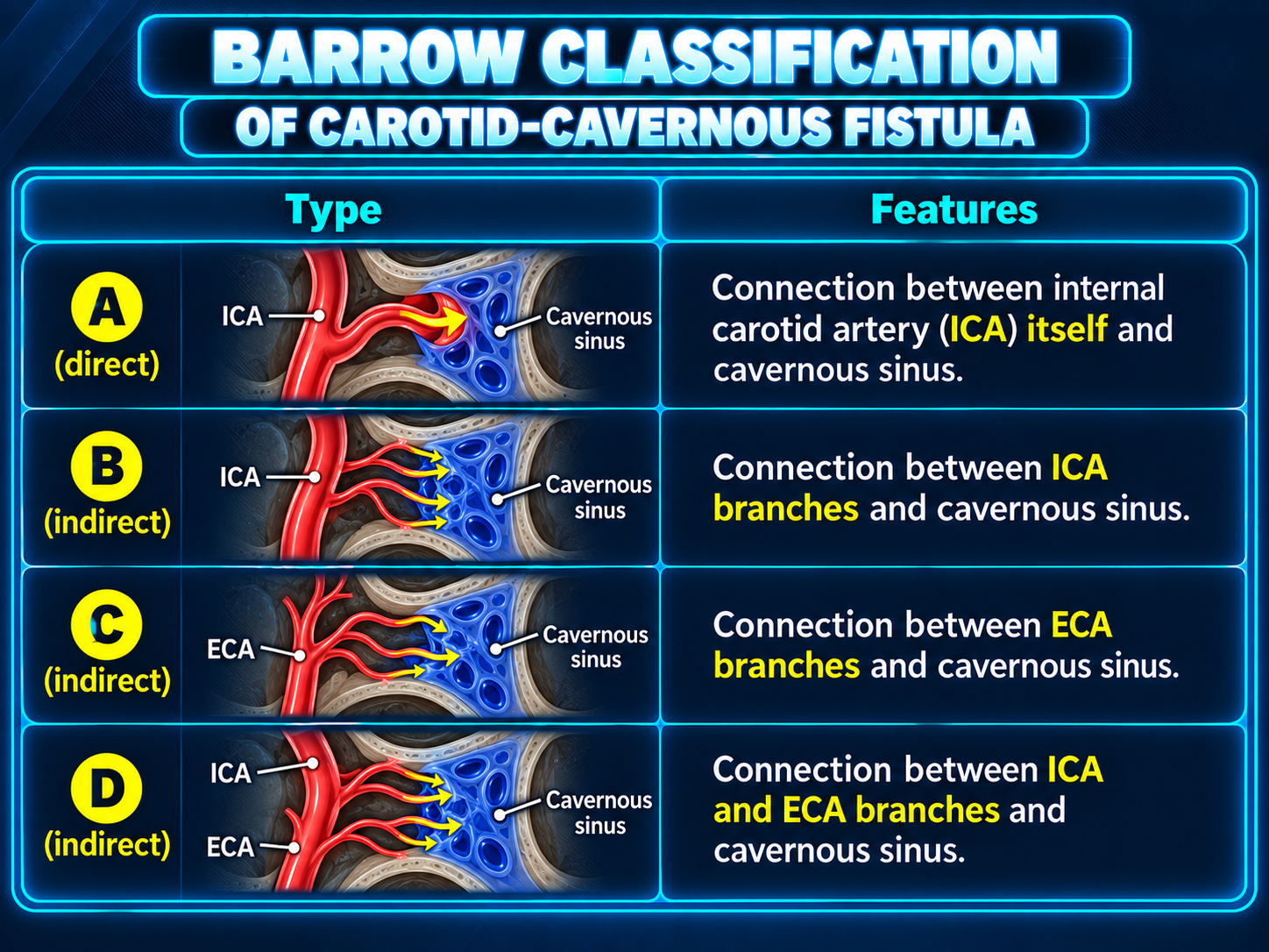 Barrow classification of carotid cavernous fistulas