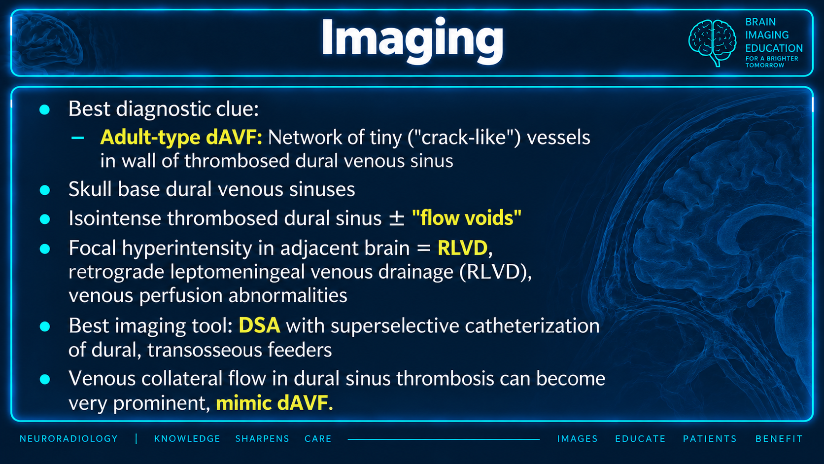 Imaging features of dural arteriovenous fistulas and CCF