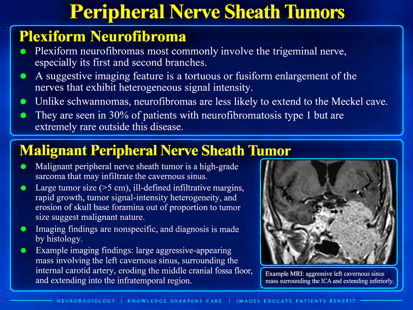 Plexiform neurofibroma and malignant peripheral nerve sheath tumor features