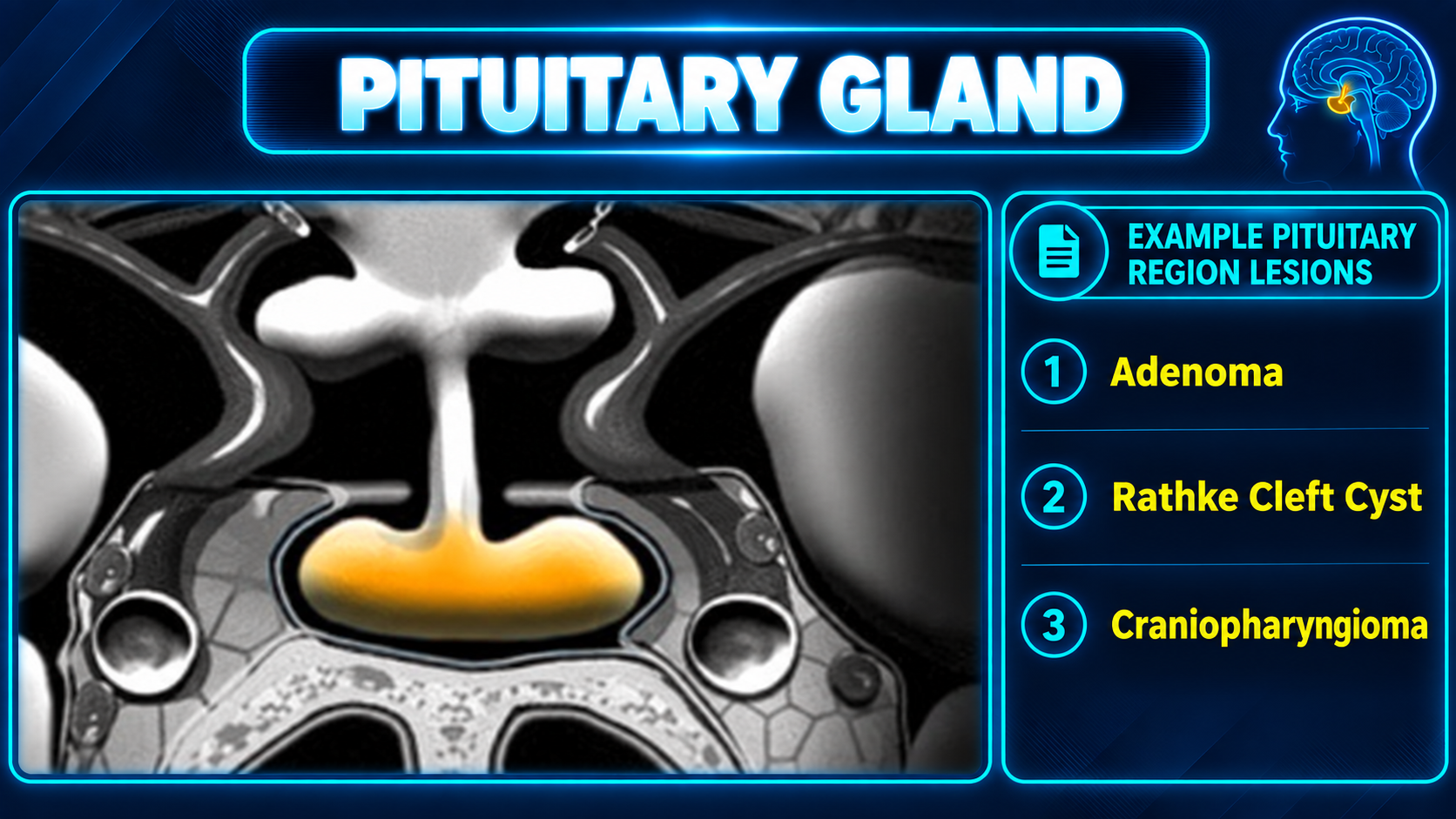 Pituitary region and example sellar lesions