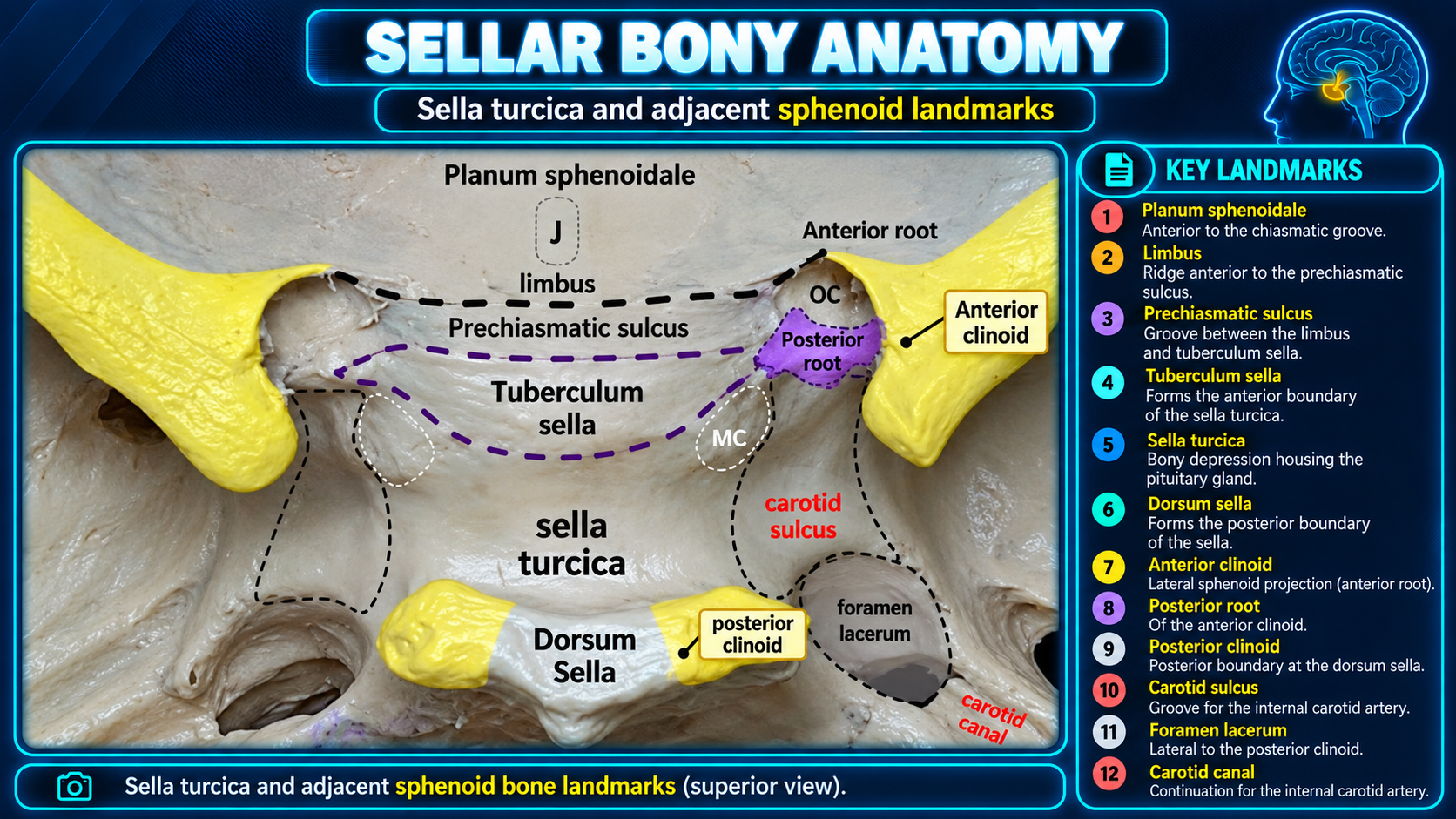 Sella turcica and adjacent sphenoid bony landmarks