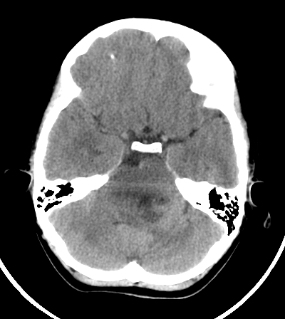 Patient C