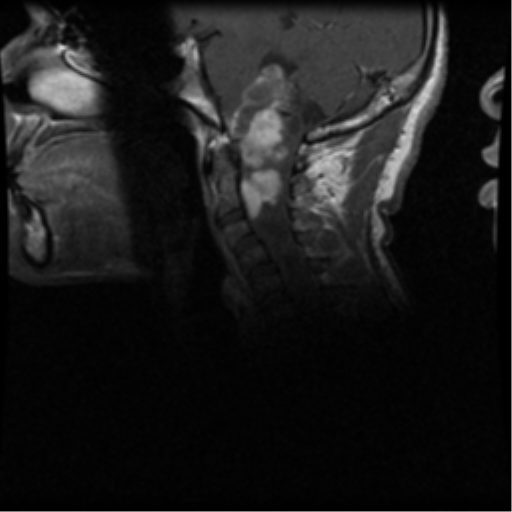 Craniocervical junction
