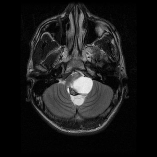 Craniocervical junction