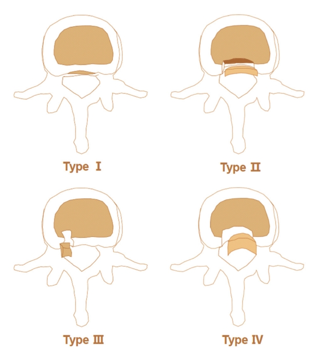 Types