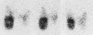 Autonomous_nodule_I123.JPG (11464 bytes)