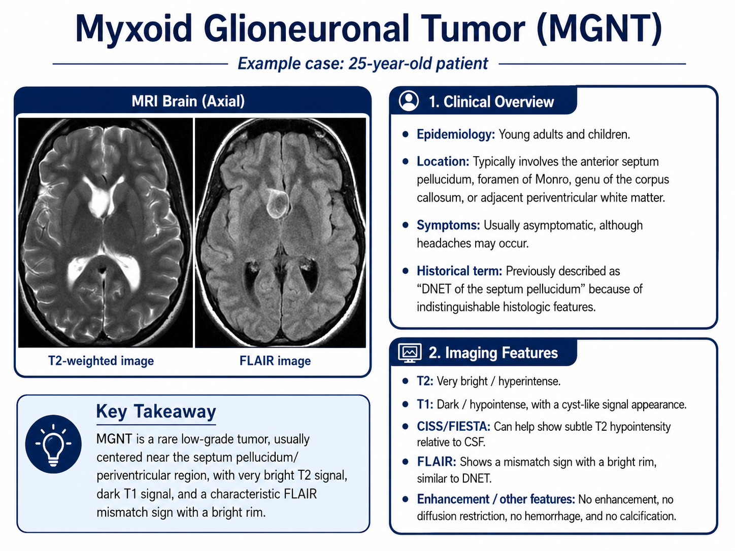 Myxoid glioneuronal tumor